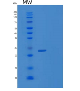 人肿瘤坏死因子相关凋亡诱导配体(TRAIL)重组蛋白