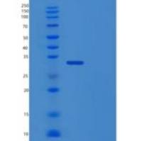 人原肌球蛋白3(TPM3)重组蛋白