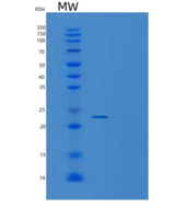 人UBE2T重组蛋白