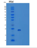 大肠杆菌肿瘤坏死因子-α人重组蛋白