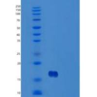 人胸腺基质淋巴细胞生成素(TSLP)重组蛋白