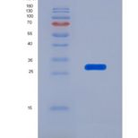 小鼠泛素羧基端酯酶L1(UCHL1)重组蛋白