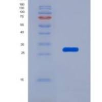 小鼠泛素羧基端酯酶L1(UCHL1)重组蛋白
