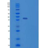 人TP53I3重组蛋白