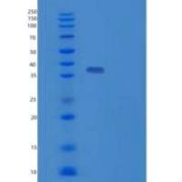 人TP53I3重组蛋白