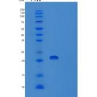 人运输蛋白粒子复合体3(TRAPPC3)重组蛋白