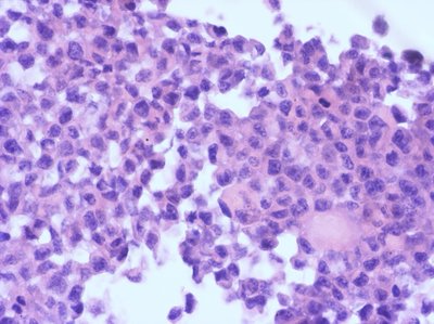 【STR鉴定】SW1116、SW1116细胞、SW1116结