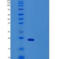 小鼠肿瘤坏死因子受体超家族成员9重组蛋白