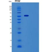 人微管蛋白β3(TUBb3)重组蛋白