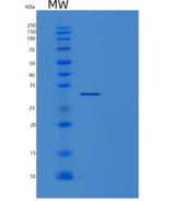 人原肌球蛋白4(TPM4)重组蛋白