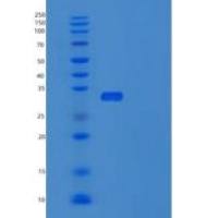 人UBE2J2重组蛋白