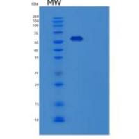人TOM1L2重组蛋白