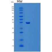 人TRIP10重组蛋白