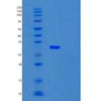 人UBTD2重组蛋白