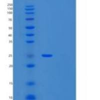 人UL16结合蛋白1(ULBP1)重组蛋白