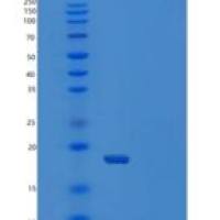 人泛素结合酶7（Ubch7）重组蛋白