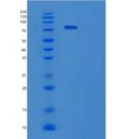 人泛素样修饰激活酶2(UBA2)重组蛋白