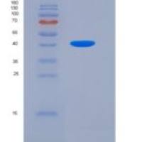人原肌球蛋白2β(TPM2)重组蛋白