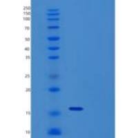 人肿瘤坏死因子受体超家族成员6重组蛋白