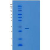 人UBE2T重组蛋白