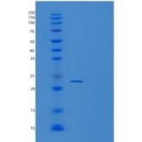 人UBE2T重组蛋白