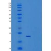 人肌钙蛋白C1-160氨基酸(Troponin C 1-160aa)重组蛋白