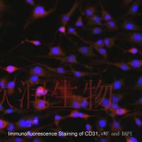 人主动脉内皮细胞系、永生化人主动脉内皮细胞、人主动脉血管内皮细胞系