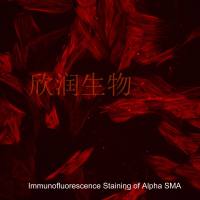 人主动脉平滑肌细胞系、永生化人主动脉平滑肌细胞