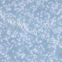 DB | DB细胞 | 人弥漫性大B细胞淋巴瘤细胞 | STR鉴定 | 镜像绮点