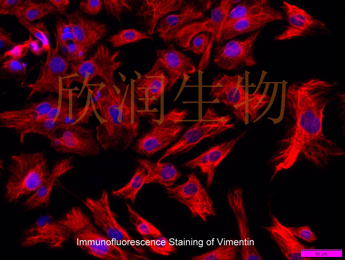 永生化大鼠心肌成纤维细胞、大鼠心肌成纤维细胞系、大鼠心脏成纤