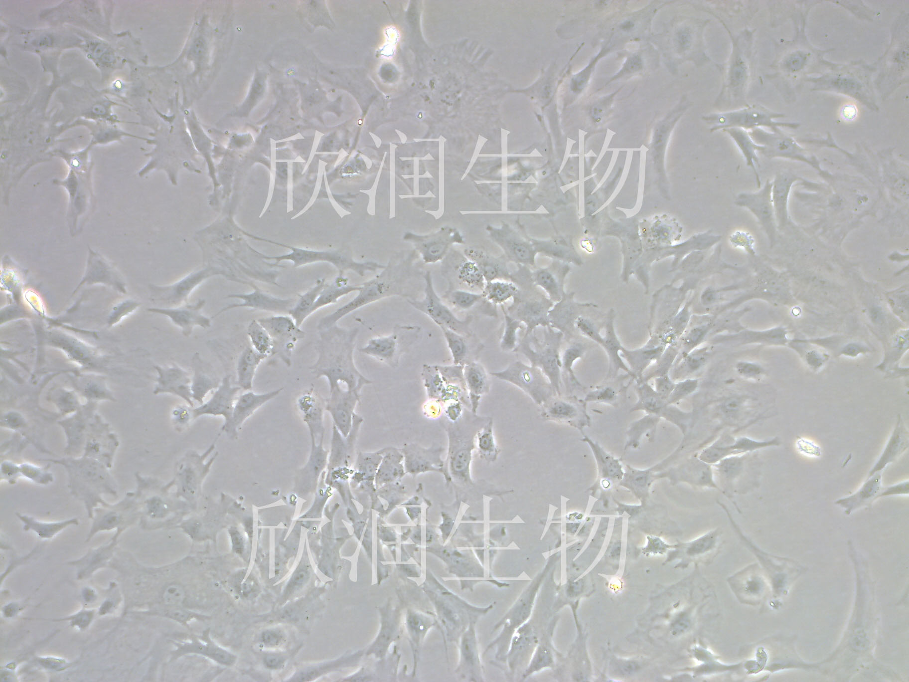 永生化大鼠心肌成纤维细胞、大鼠心肌成纤维细胞系、大鼠心脏成纤