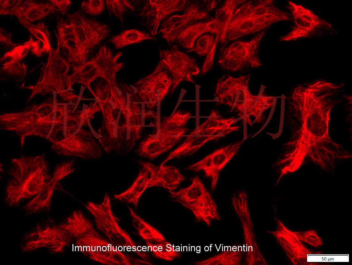 永生化大鼠心肌成纤维细胞、大鼠心肌成纤维细胞系、大鼠心脏成纤