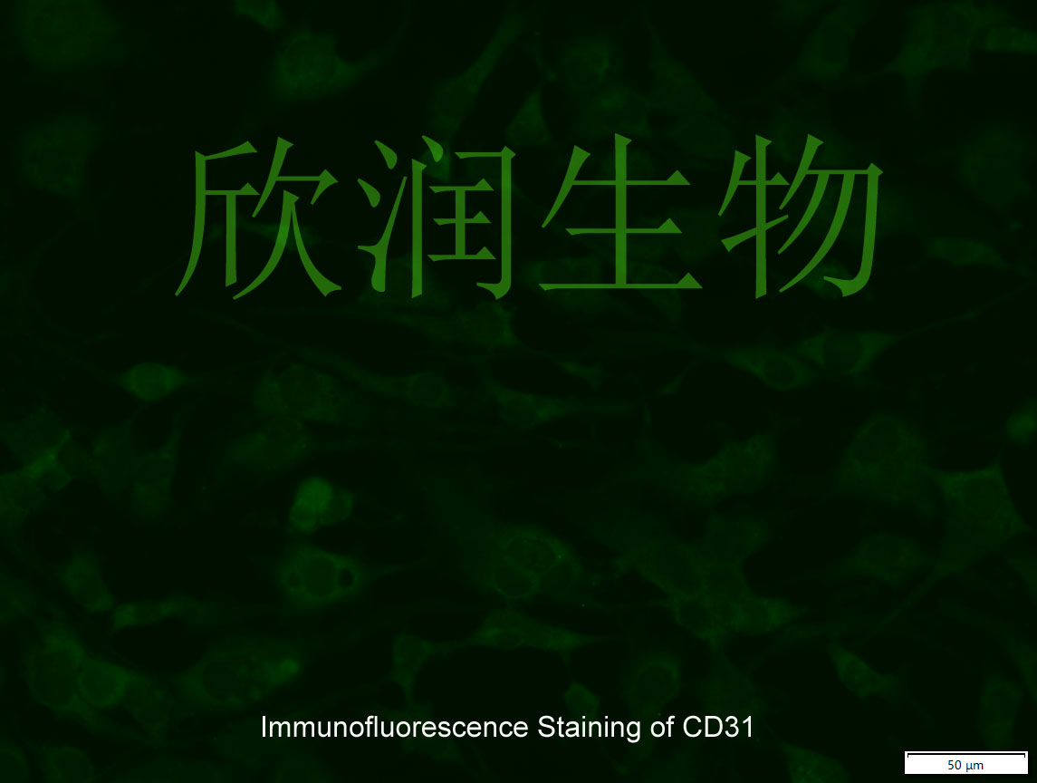 人主动脉内皮细胞系、永生化人主动脉内皮细胞、人主动脉血管内皮