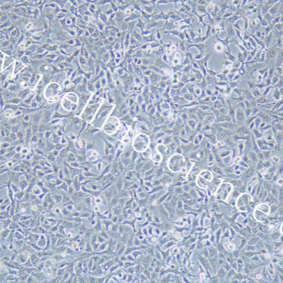NCI-H1568 人非小细胞肺癌细胞  STR鉴定 镜像绮点（Cellverse）