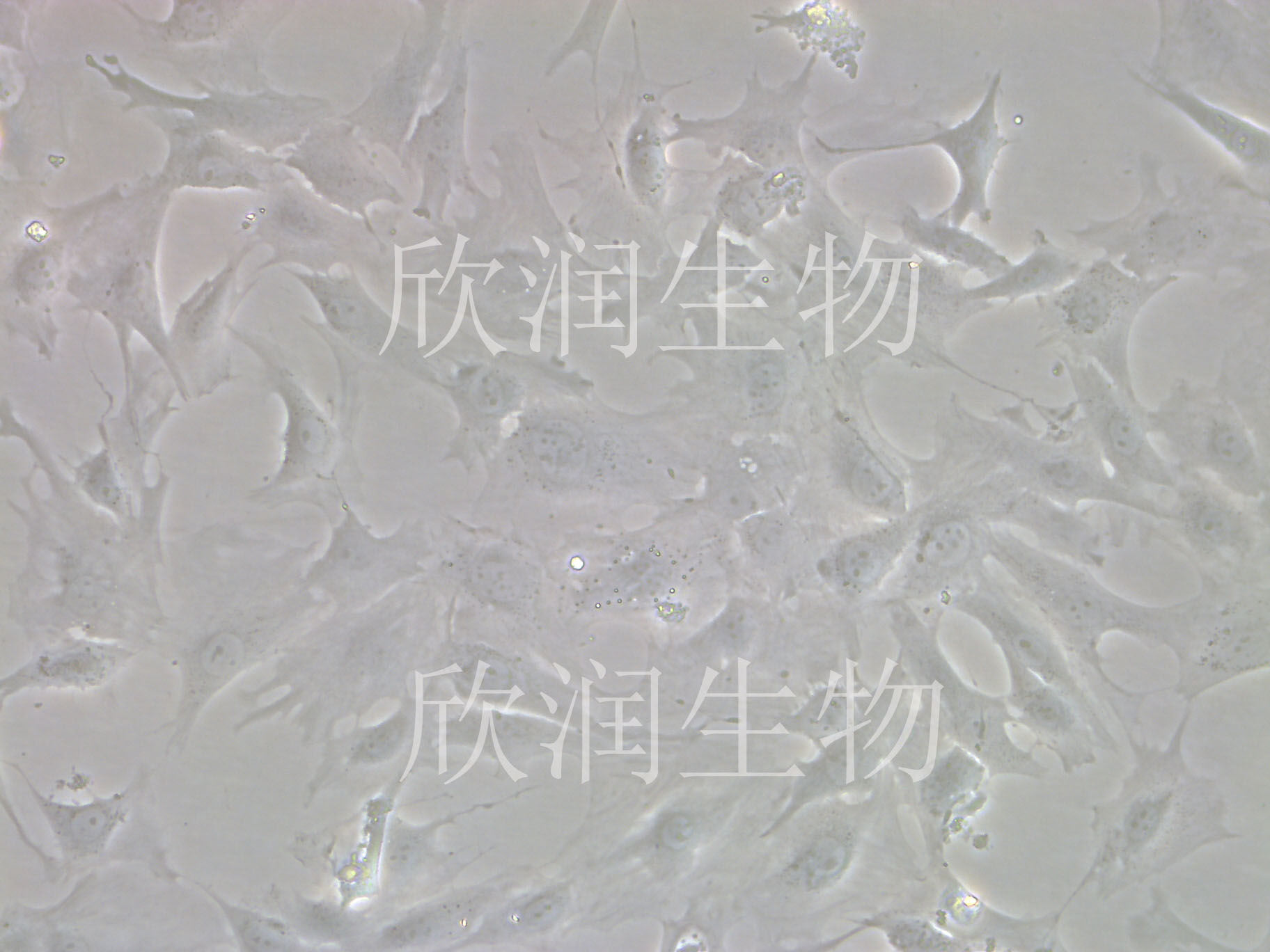 永生化大鼠心肌成纤维细胞、大鼠心肌成纤维细胞系、大鼠心脏成纤