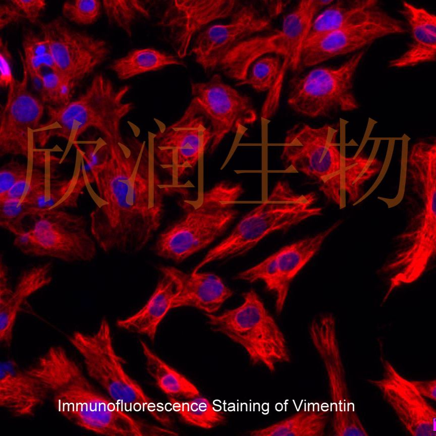 永生化大鼠心肌成纤维细胞、大鼠心肌成纤维细胞系