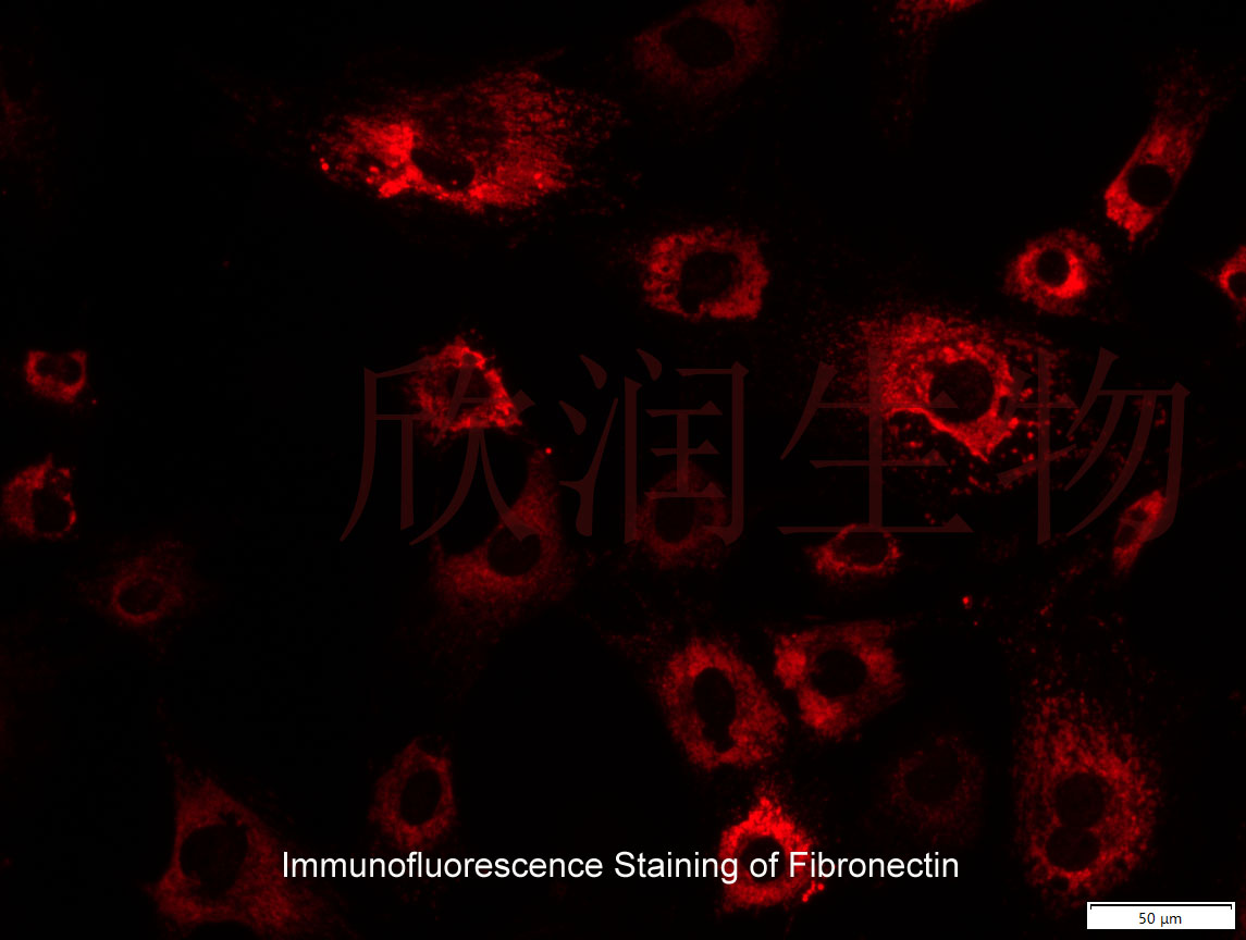 永生化大鼠心肌成纤维细胞、大鼠心肌成纤维细胞系、大鼠心脏成纤