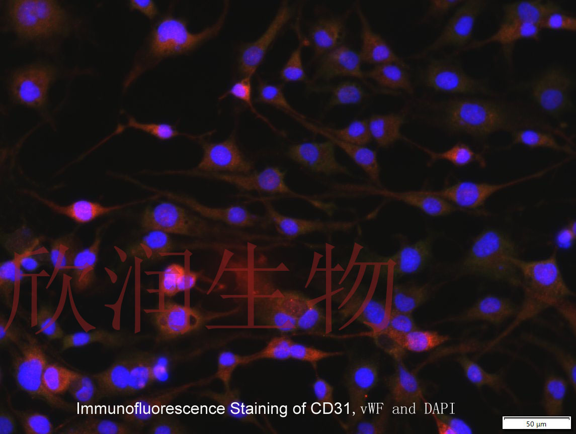 人主动脉内皮细胞系、永生化人主动脉内皮细胞、人主动脉血管内皮