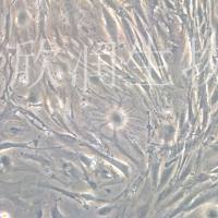 小鼠肾足突细胞系、永生化小鼠肾足突细胞、小鼠肾脏足细胞系、小鼠足细胞系