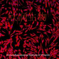人皮肤成纤维细胞系、永生化人皮肤成纤维细胞、人真皮成纤维细胞系、永生化人真皮成纤维细胞