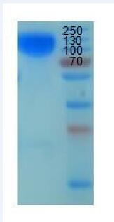 癌胚抗原 （CEA）