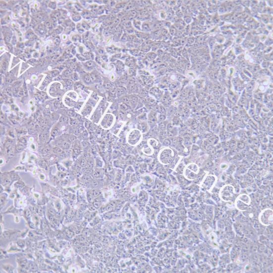 BHT101 人甲状腺癌细胞/STR鉴定/镜像绮点（Cellverse）