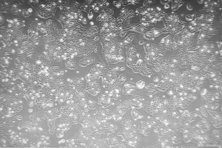 贴壁细胞培养时突然飘了很多怎么办？