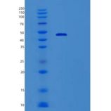 人Vav1癌基因(VAV1)重组蛋白