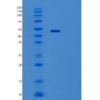 人Vav1癌基因(VAV1)重组蛋白