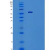 人色氨酰tRNA合成酶(WARS)重组蛋白