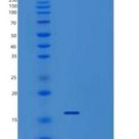 人肝配蛋白A4/EFNA4(C-6His)重组蛋白