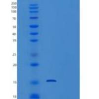 人nkg 2-A/nkg 2-B II型整体膜(N-8His)重组蛋白
