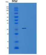 人YAE1D1重组蛋白