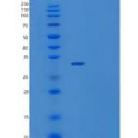 人AN1-型锌指域蛋白1(ZFAND1)重组蛋白